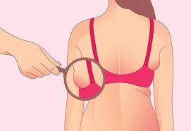 Benefits of Bra Bulge Liposuction