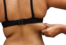 Why Choose Bra Bulge Liposuction in Turkey
