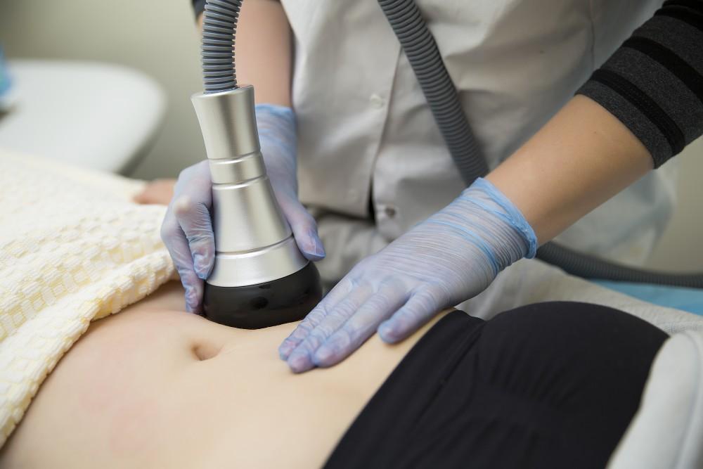 laser liposuction in Turkey